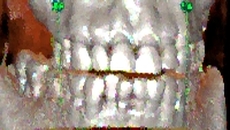 Bild "Start:3D-Roentgen_Zahnarzt.jpg"