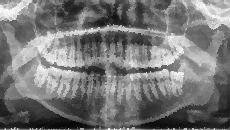 Bild "Start:Roentgen_Zahnarzt.jpg"